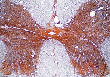 Engineered-Design-Insider-Cross section of spinal cord under the microscope dreamstime_l_130916691Oil-Gas-Automotive-Aerospace-Industry-Magazine Cross section of spinal cord under a microscope.